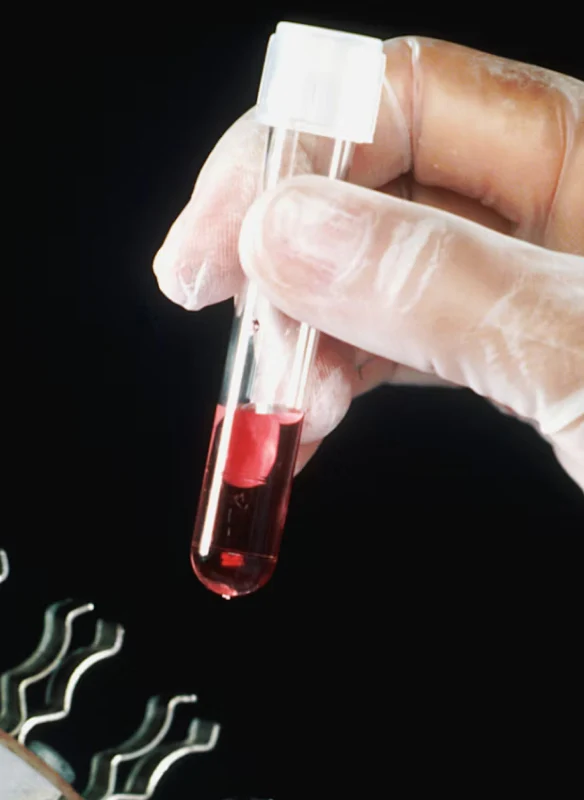 Comprehensive Lab Testing